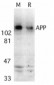 APP Antibody (CT)